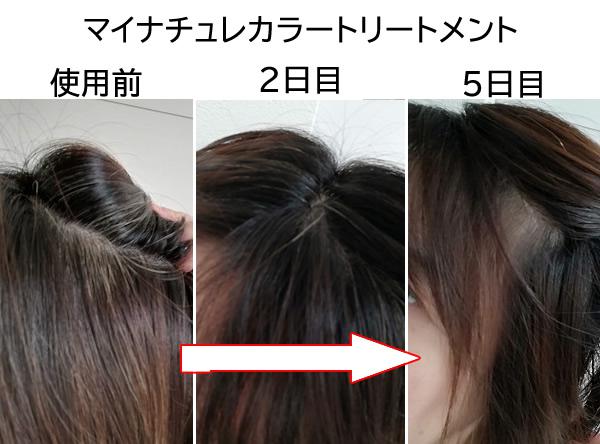 [My Nature] After dyeing gray hair with a color treatment, the effect was as good as the word-of-mouth evaluation, so a review