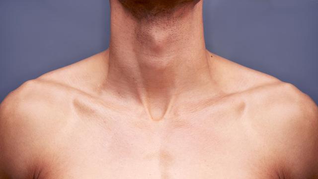 ¿Por qué es importante contar con un rutina de cuidado del cuello?