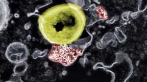 Mit Nanopartikeln gegen gefährliche Bakterien 