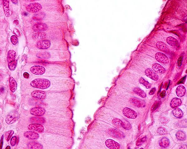 Epithelial Cells 
