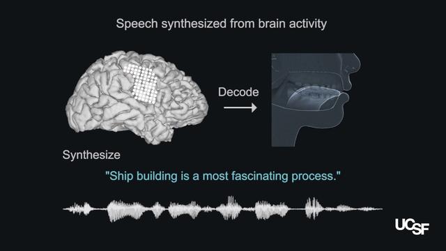 Big brain two halfball machines can speak