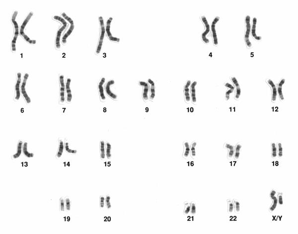 Wie das Y-Chromosom wirklich Männer und Frauen unterscheidet 