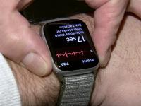 I like IT A smart watch can save your life. He even knows how to do an EKG