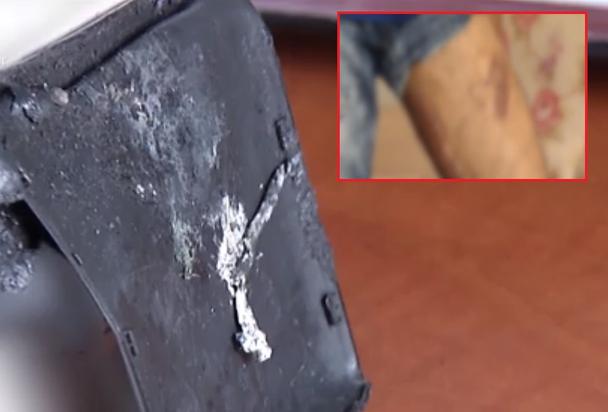 A teenager from Bucharest exploded his phone in his pocket."The smoke came out of jeans"