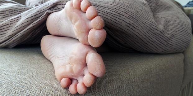 Métodos seguros para retirar la piel muerta de los pies