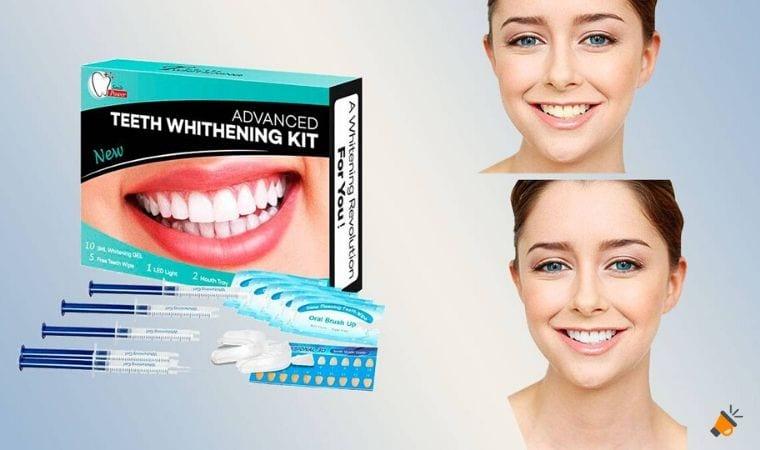 Consigue una sonrisa radiante con los 8 mejores 'kits' de blanqueamiento dental para casa 