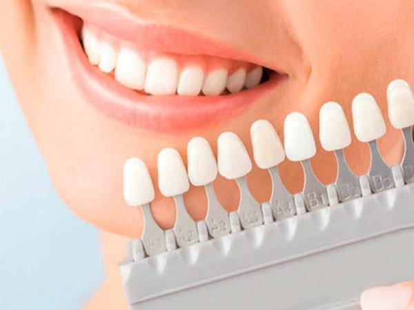 Consigue unos dientes blancos y una buena salud oral con estos productos top ventas