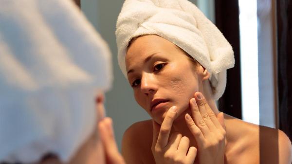 Trucos para que el mal tiempo, la calefacción y la mascarilla no dañen tu rostro