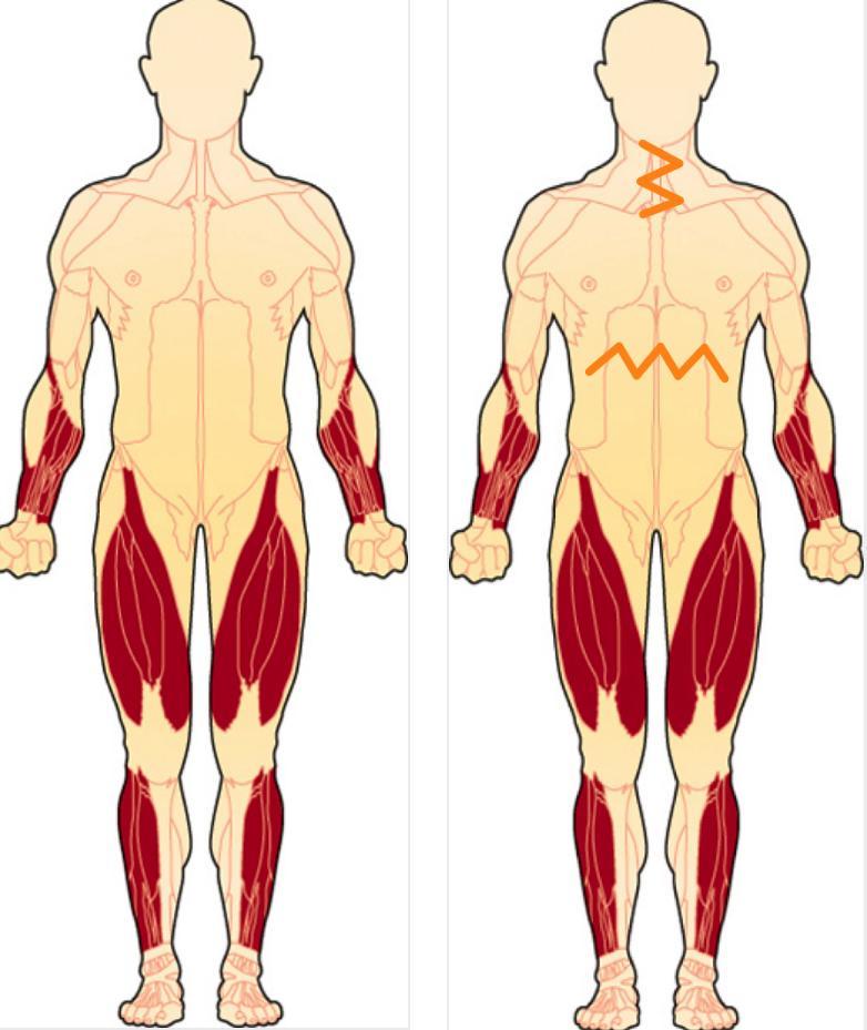 Inclusion Body Myositis Market Analysis, by 2031 | Acceleron Pharma Inc, Kpi Therapeutics Inc, Milo Biotechnology Llc, Nobelpharma Co Ltd 