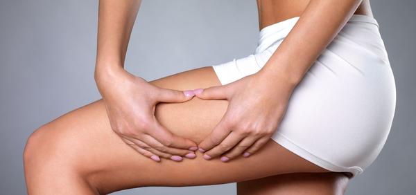 10 things you should know about cellulite
