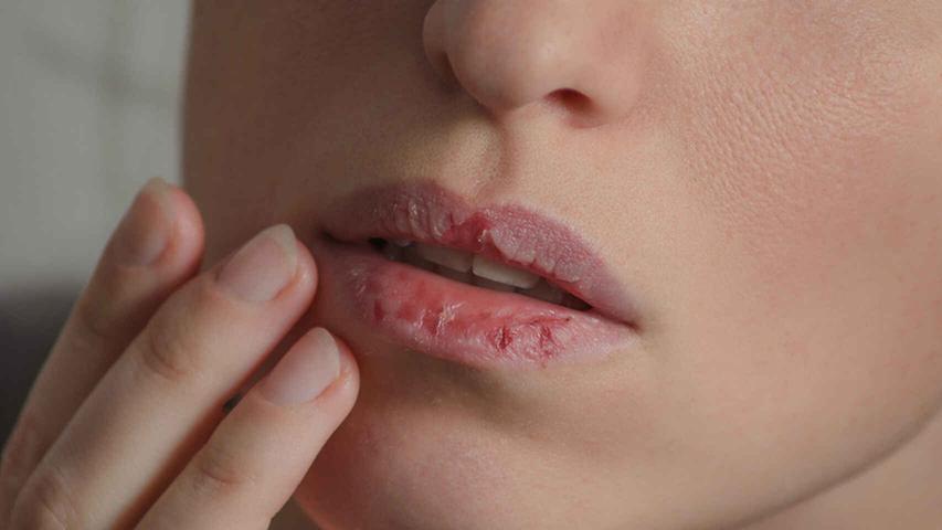 Belleza Cold cracked lips: how to cure them with natural exfoliants 