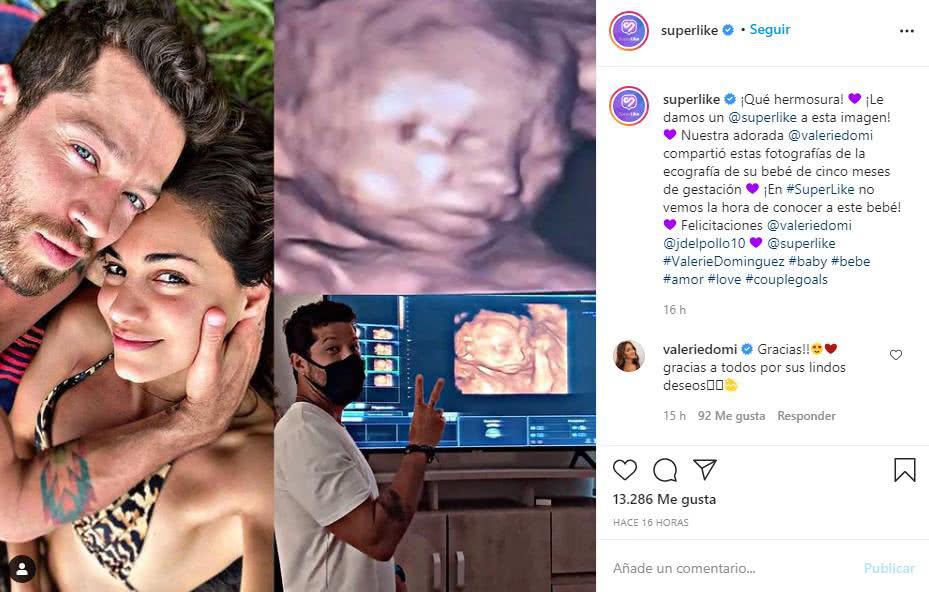 Valerie Domínguez shows her baby in a 3D ultrasound: "How beautiful"