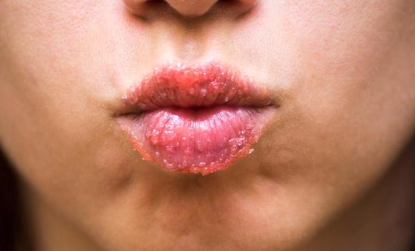 ¿Es bueno o malo exfoliarse los labios? 