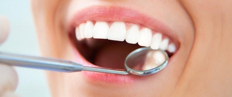 Comment avoir les dents blanches : produits naturels et bons gestes d’hygiène dentaire 