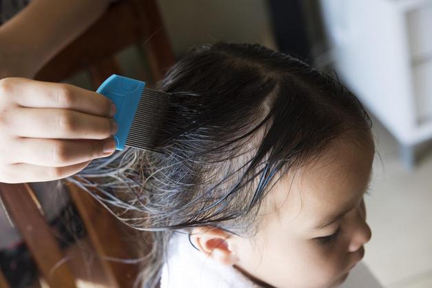 How to use vinegar for lice