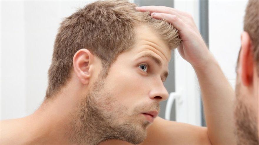 Caída del cabello: cómo detectar uno de los mayores miedos del hombre y qué hacer para frenarlo 