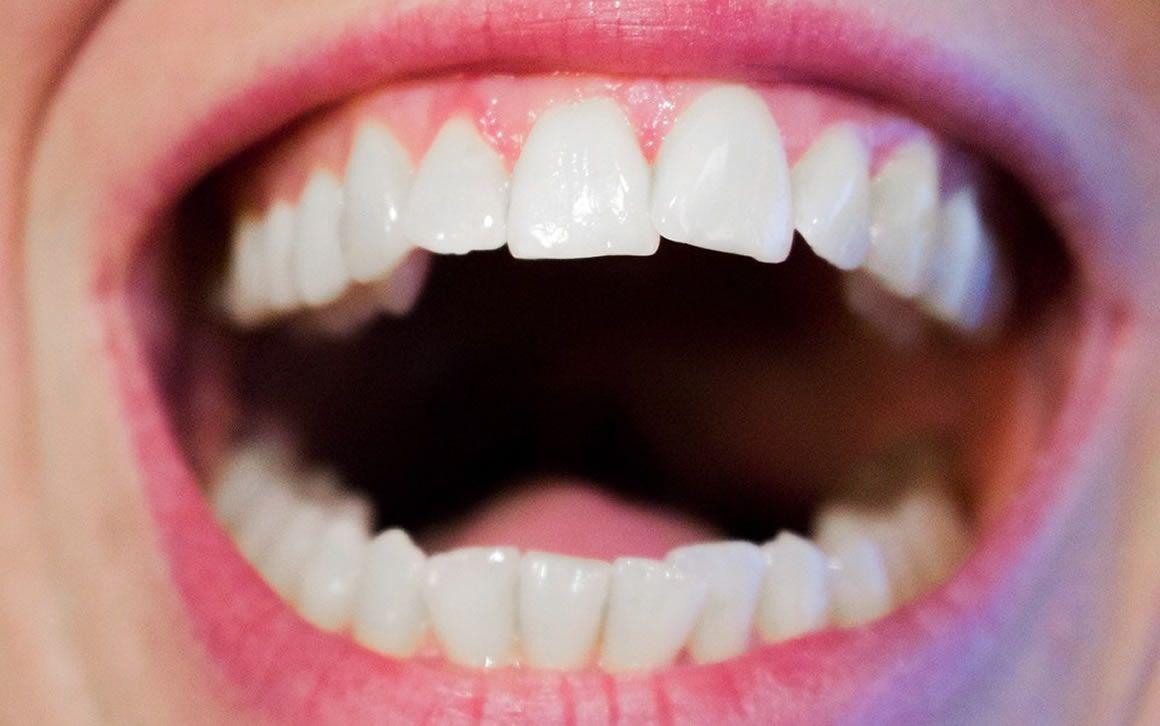The Nation Women with chronic gum infection at greater risk of developing cancer