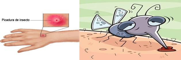 Cómo prevenir y tratar las picaduras de insectos