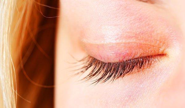 Do your eyes and very dry notes sting?Discover if you suffer eyelid dermatitis