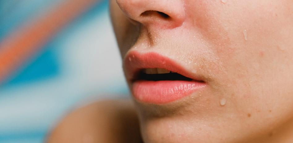Burned lips: how to calm them and cure them