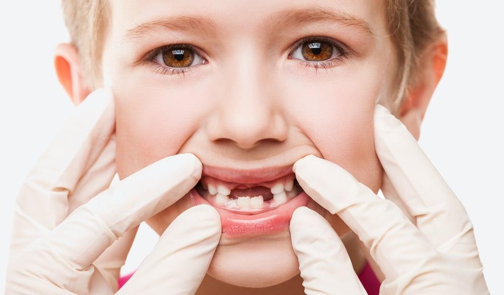 Nelžete dítěti před návštěvou zubaře. A slibte mu odměnu, říká lékařka 