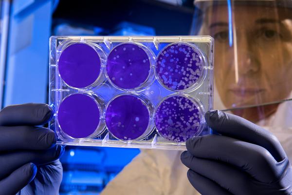 Scientists describe how a woman overcame a multirresistant bacterial infection