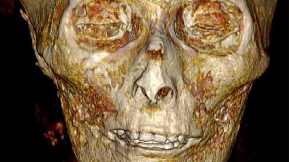 Usan tomografía 3D para “desenvolver” momia de forma digital 