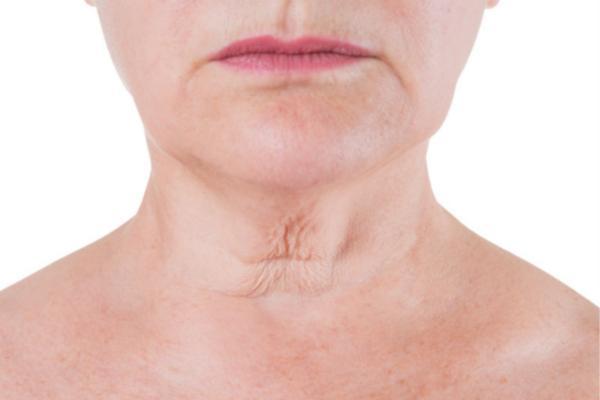 How to eliminate wrinkles in the neck - Effective tips