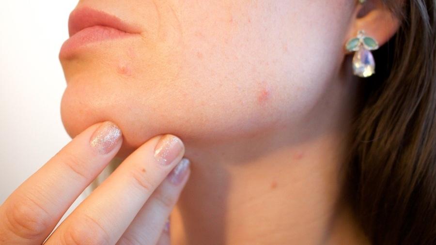 ¿Problemas en la piel por causa del tapabocas? Esta es la manera de evitarlos | Noticias de El Salvador