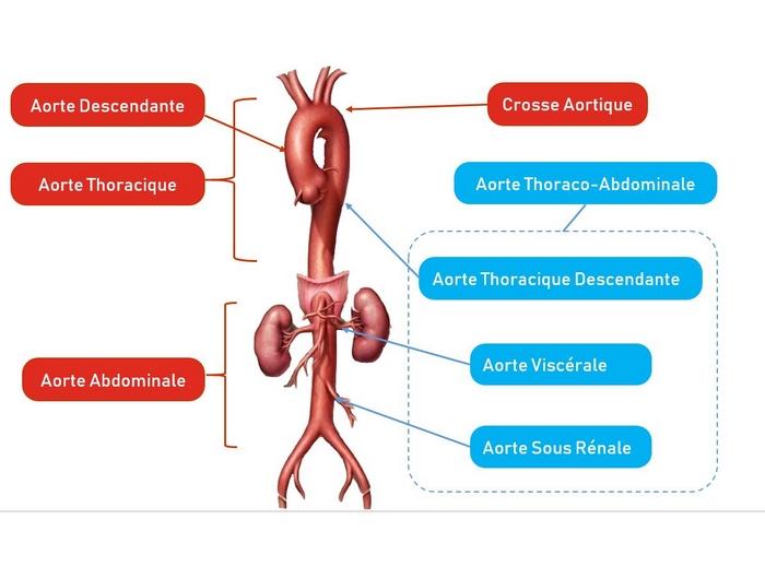 L’aorte abdominale : fonctions, maladies et traitements 
