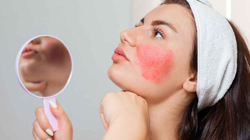 Woman Is there an allergy to cosmetics? Tips to prevent and treat skin reactions