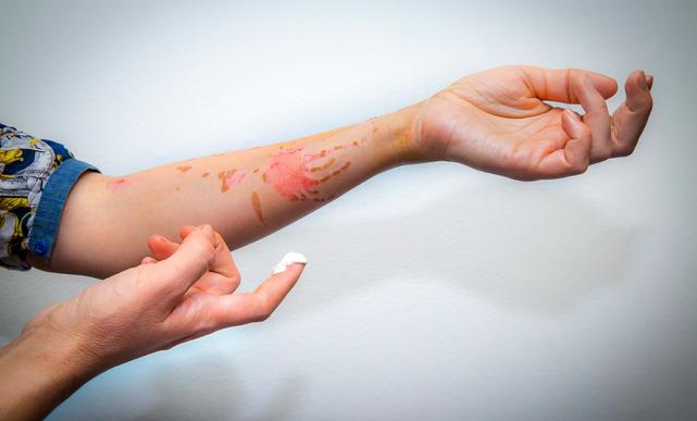 Tratamiento de pieles agredidas