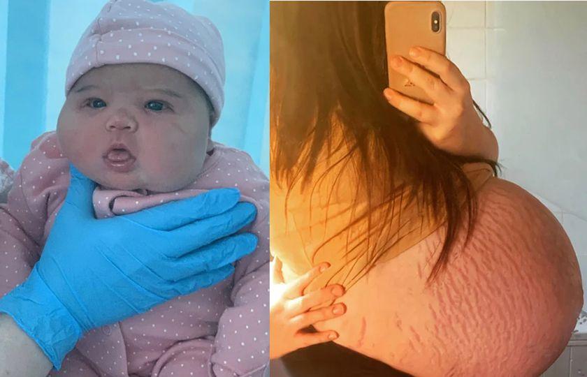 Una joven de 21 años da a luz a una bebé de casi 6 kilos cuando los médicos pensaban que iba a tener gemelos