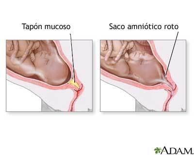 Tapón mucoso en el embarazo: qué es y cuándo se produce su expulsión Tapón mucoso en el embarazo: qué es y cuándo se produce su expulsión