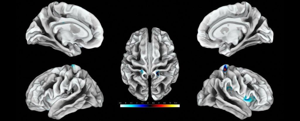 Por primera vez, científicos lograron mapear las regiones del cerebro que responden al clítoris 