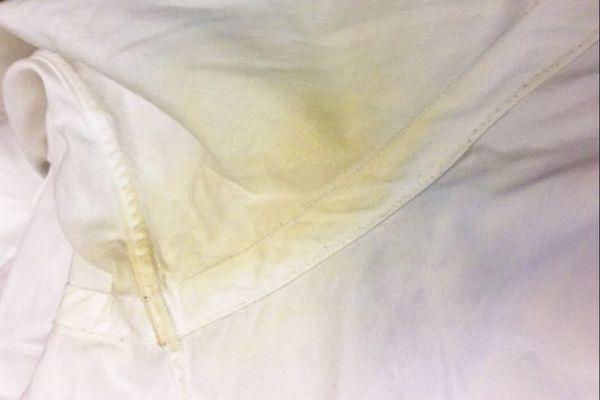 Perspiration: how to remove yellow stains from clothing?