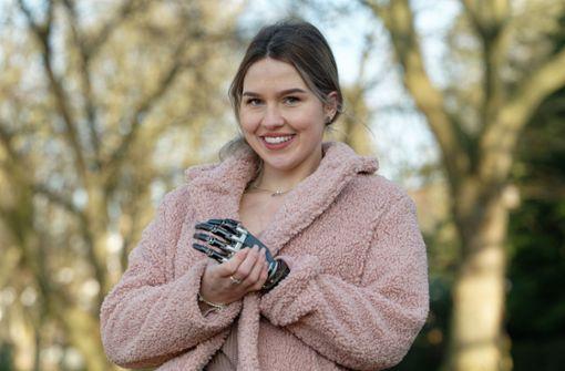 Student with a prosthetic arm wants to be a beauty queen