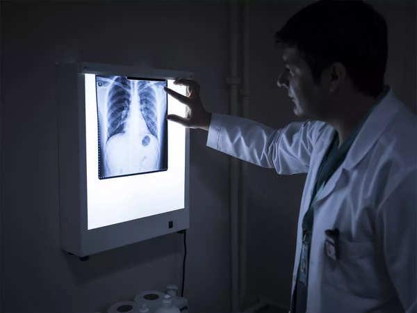 COVID-19: Novo 'jogo- Tecnologia de raios X em mudança desenvolvida que pode detectar o coronavírus em minutos 