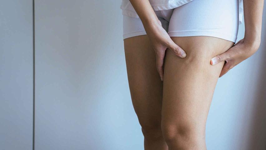 How to prevent and cure the rubbing in the thighs with home remedies