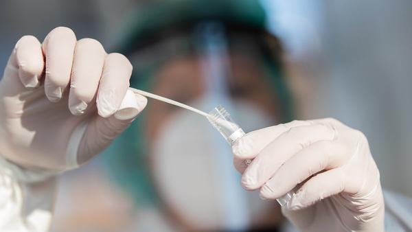 Experten vermuten: Omikron könnte in HIV-Patienten entstanden sein 