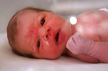 Abgeflachter Hinterkopf bei Säuglingen: Eltern können gegensteuern