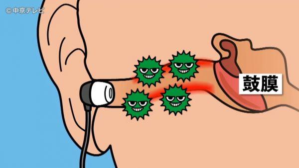  It is dangerous to use earphones for a long time!Fear of "ear mold" that increases rapidly during the rainy season (July 10, 2019) --Excite News