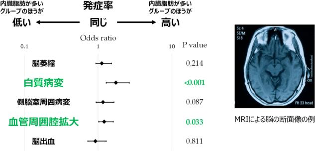 内臓脂肪が多いと糖尿病だけでなく認知症リスクも上昇 内臓脂肪を減らせばリスクを減らせる | ニュース | 糖尿病ネットワーク 内臓脂肪が多いと糖尿病だけでなく認知症リスクも上昇 内臓脂肪を減らせばリスクを減らせる | ニュース | 糖尿病ネットワーク