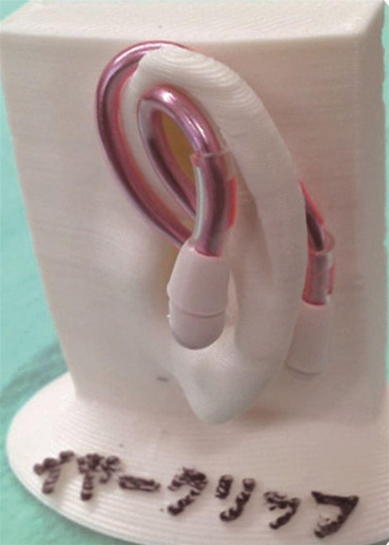  JDF's buried ear orthodontic appliance, what is the key to reducing the burden on the skin? ｜ New Switch by Nikkan Kogyo Shimbun