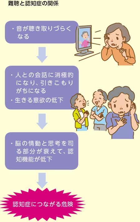 【将来、難聴にならない方法】耳鳴りや認知症は難聴のせい？ 難聴の原因とタイプ（OurAge） - Yahoo!ニュース