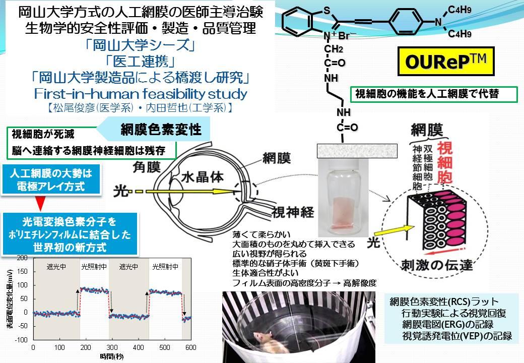 失明患者の視覚回復をめざす「人工網膜」　網膜色素変性症を改善（夕刊フジ） - Yahoo!ニュース