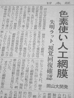 失明患者の視覚回復をめざす「人工網膜」　網膜色素変性症を改善（夕刊フジ） - Yahoo!ニュース 