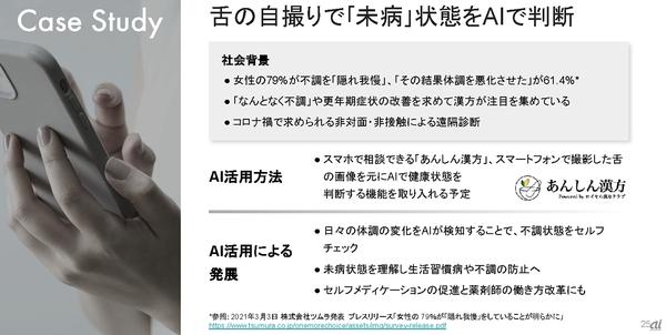 AI inside、AIモデル開発サービスを強化--少ない画像でも精度の高い学習 - ZDNet Japan 