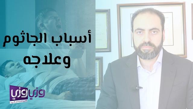 هل سمعت عن الجاثوم؟ وما علاقته بالجن؟ وكيف يفسّر العلم هذه الظاهرة؟ 