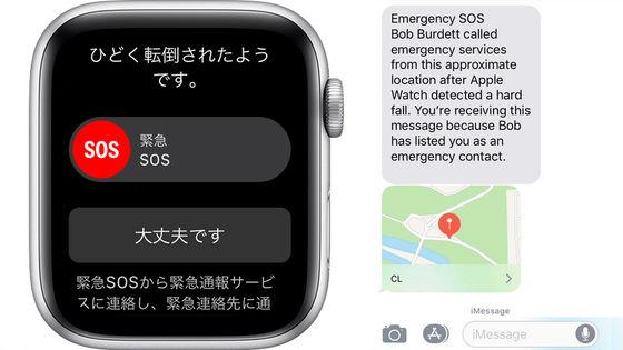 
 ホテルで転んで失神した女性、Apple Watchに命を救われたと語る。直前に転倒検出を有効にしたおかげ